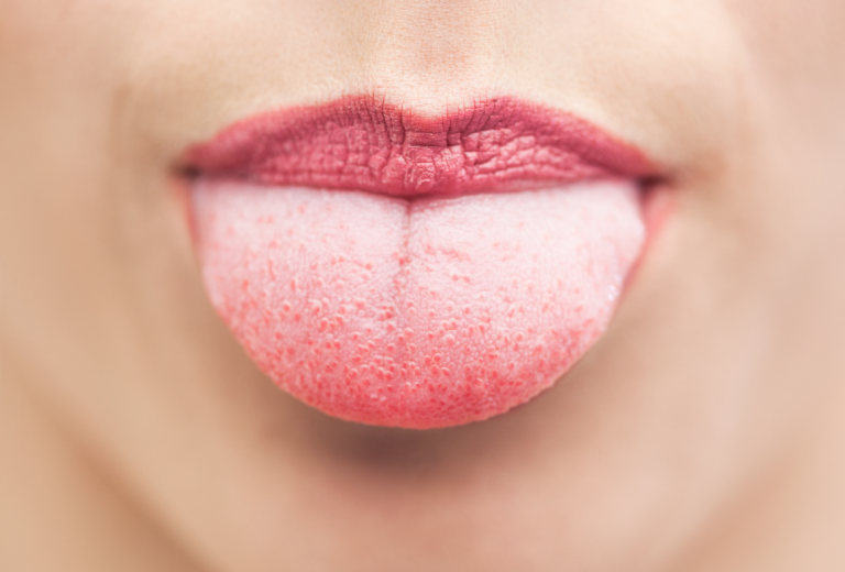 Nehl Dental Why Everyone Should Consider Tongue Scraping Nehl Dental